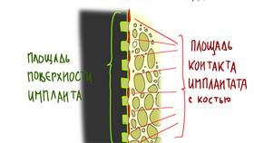 Что означает приставка 